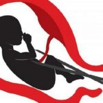 aborsi